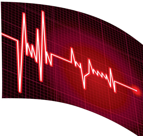 TTE140 - Smith Walbridge Band Products