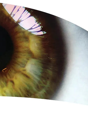 TTH304 - Smith Walbridge Band Products